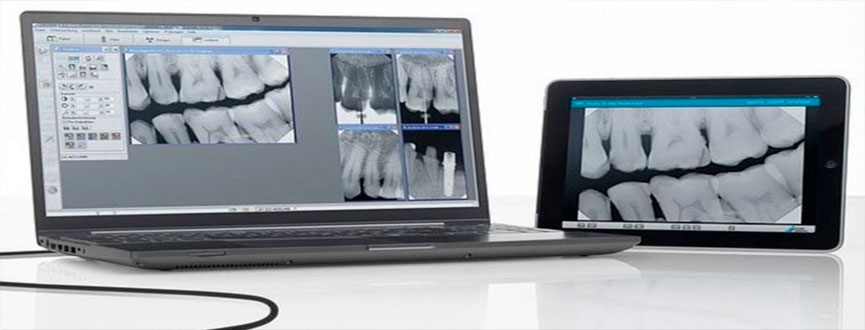 Dental Digital X-Ray in Gandhinagar